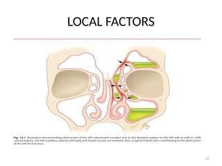 14
LOCAL FACTORS
 