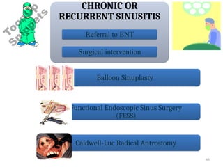 48
CHRONIC OR
RECURRENT SINUSITIS
Referral to ENT
Surgical intervention
Balloon Sinuplasty
Functional Endoscopic Sinus Surgery
(FESS)
Caldwell-Luc Radical Antrostomy
 
