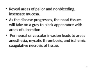 59
• Reveal areas of pallor and nonbleeding,
insensate mucosa.
• As the disease progresses, the nasal tissues
will take on a gray to black appearance with
areas of ulceration
• Perineural or vascular invasion leads to areas
anesthesia, mycotic thrombosis, and ischemic
coagulative necrosis of tissue.
 