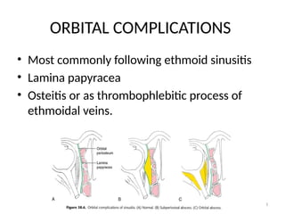 64
ORBITAL COMPLICATIONS
• Most commonly following ethmoid sinusitis
• Lamina papyracea
• Osteitis or as thrombophlebitic process of
ethmoidal veins.
 