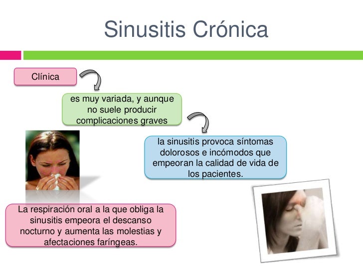 Una Sinusitis Crnica No Tratada Puede Poner En Riesgo La Una Sinusitis Crnica No Tratada Puede Poner En Riesgo La