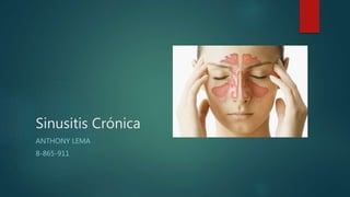 Sinusitis Crónica
ANTHONY LEMA
8-865-911
 