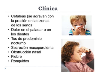 Clínica 
• Cefaleas (se agravan con 
la presión en las zonas 
de los senos 
• Dolor en el paladar o en 
los dientes 
• Tos de predominio 
nocturno 
• Secreción mucopurulenta 
• Obstrucción nasal 
• Fiebre 
• Ronquidos 
 