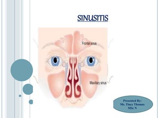 SINUSITIS
Presented By:
Ms. Tincy Thomas
MSc N
 