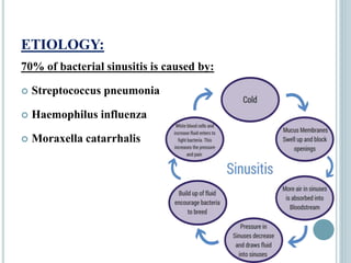 ETIOLOGY:
70% of bacterial sinusitis is caused by:
 Streptococcus pneumonia
 Haemophilus influenza
 Moraxella catarrhalis
 