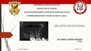 SINUSITIS ODONTOGENA
UNIVERSIDAD AUTONOMA DE SINALOA
HOSPITAL CIVIL DE CULIACAN
CENTRO DE INVESTIGACIÓN Y DOCENCIA EN CIENCIAS DE LA SALUD
OTORRINOLARINGOLOGIA Y CIRUGIA DE CABEZA Y CUELLO
DR. ANGEL CASTRO URQUIZO
R1 ORL
CULIACAN SINALOA AGOSTO 2016
 