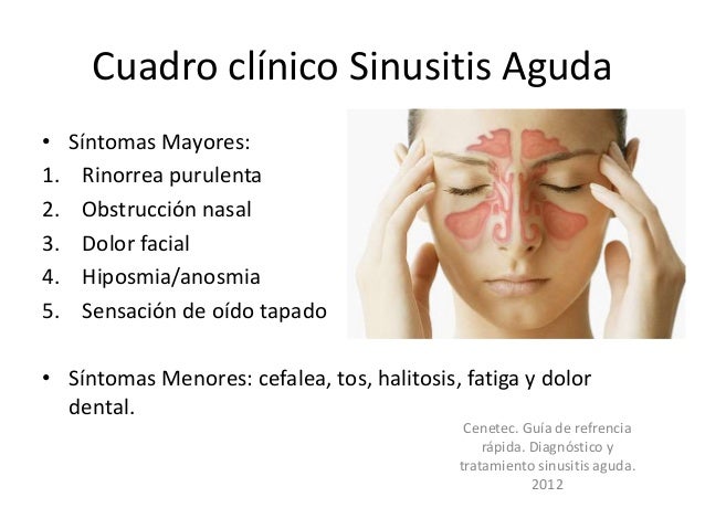 Una Sinusitis Crnica No Tratada Puede Poner En Riesgo La