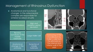 Sinus lift procedures.pptx
