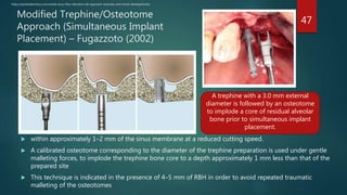 Sinus lift procedures. final copy of presentation pptx | PPTX