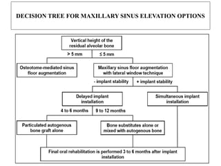 DECISION TREE FOR MAXILLARY SINUS ELEVATION OPTIONS
 