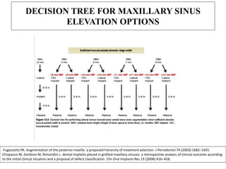 DECISION TREE FOR MAXILLARY SINUS
ELEVATION OPTIONS
Fugazzotto PA. Augmentation of the posterior maxilla: a proposed hierarchy of treatment selection. J Periodontol 74 (2003):1682–1691.
Chiapasco M, Zaniboni M, Rimondini L. dental implants placed in grafted maxillary sinuses: a retrospective analysis of clinical outcome according
to the initial clinical situation and a proposal of defect classification. Clin Oral Implants Res 19 (2008):416–428.
 