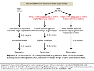 Fugazzotto PA. Augmentation of the posterior maxilla: a proposed hierarchy of treatment selection. J Periodontol 74 (2003):1682–1691.
Chiapasco M, Zaniboni M, Rimondini L. dental implants placed in grafted maxillary sinuses: a retrospective analysis of clinical outcome according
to the initial clinical situation and a proposal of defect classification. Clin Oral Implants Res 19 (2008):416–428.
 