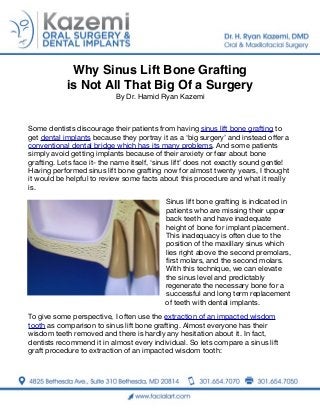 Why Sinus Lift Bone Grafting
is Not All That Big Of a Surgery
By Dr. Hamid Ryan Kazemi
Dentist
Some dentists discourage their patients from having sinus lift bone grafting to
get dental implants because they portray it as a ‘big surgery’ and instead oﬀer a
conventional dental bridge which has its many problems. And some patients
simply avoid getting implants because of their anxiety or fear about bone
grafting. Lets face it- the name itself, ‘sinus lift’ does not exactly sound gentle!
Having performed sinus lift bone grafting now for almost twenty years, I thought
it would be helpful to review some facts about this procedure and what it really
is.
Sinus lift bone grafting is indicated in
patients who are missing their upper
back teeth and have inadequate
height of bone for implant placement.
This inadequacy is often due to the
position of the maxillary sinus which
lies right above the second premolars,
ﬁrst molars, and the second molars.
With this technique, we can elevate
the sinus level and predictably
regenerate the necessary bone for a
successful and long term replacement
of teeth with dental implants.
To give some perspective, I often use the extraction of an impacted wisdom
tooth as comparison to sinus lift bone grafting. Almost everyone has their
wisdom teeth removed and there is hardly any hesitation about it. In fact,
dentists recommend it in almost every individual. So lets compare a sinus lift
graft procedure to extraction of an impacted wisdom tooth:

 