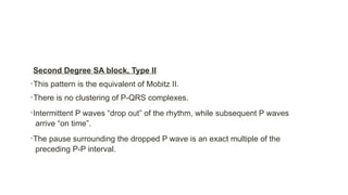 Second Degree SA block, Type II
•This pattern is the equivalent of Mobitz II.
•There is no clustering of P-QRS complexes.
•Intermittent P waves “drop out” of the rhythm, while subsequent P waves
arrive “on time”.
•The pause surrounding the dropped P wave is an exact multiple of the
preceding P-P interval.
 