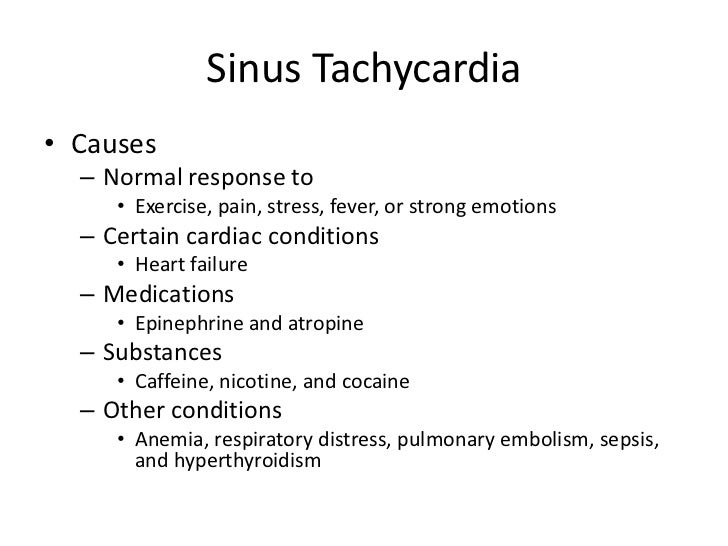 Sinus Tachycardia