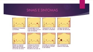 SINAIS E SINTOMAS

 