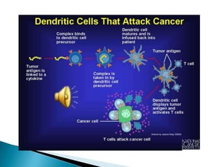  immune signaling factor (GM-CSF) that helps the APCs to mature.Preparation of Sipuleucel-T: