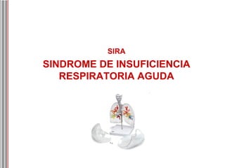 SINDROME DE INSUFICIENCIA RESPIRATORIA AGUDA SIRA 