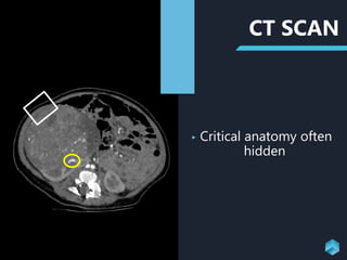 CT SCAN
‣ Critical anatomy often
hidden
 