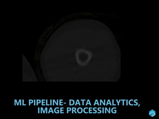ML PIPELINE- DATA ANALYTICS,
IMAGE PROCESSING
 