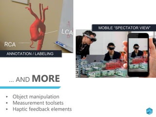 … AND MORE
MOBILE “SPECTATOR VIEW”
ANNOTATION / LABELING
‣ Object manipulation
‣ Measurement toolsets
‣ Haptic feedback elements
 