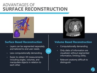 ADVANTAGES OF
SURFACE RECONSTRUCTION
VS
Surface Based Reconstruction
• Layers can be segmented separately
and tailored to end user needs.
• Less-computationally demanding
• Easier to obtain 3D measurements,
including angles, volumes, and
manipulate objects in relation to
each other
Volume Based Reconstruction
• Computationally demanding
• Only slabs of information are
visualized, without segmented
information, limiting utility.
• Relevant anatomy difficult to
distinguish
 