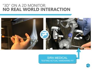 “3D” ON A 2D MONITOR:
NO REAL WORLD INTERACTION
=
SIRA MEDICAL
TESTING ACTUAL HARDWARE FIT
 