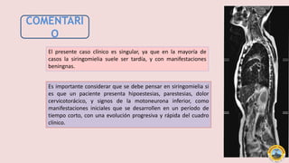 COMENTARI
O
El presente caso clínico es singular, ya que en la mayoría de
casos la siringomielia suele ser tardía, y con manifestaciones
beningnas.
Es importante considerar que se debe pensar en siringomielia si
es que un paciente presenta hipoestesias, parestesias, dolor
cervicotorácico, y signos de la motoneurona inferior, como
manifestaciones iniciales que se desarrollen en un período de
tiempo corto, con una evolución progresiva y rápida del cuadro
clínico.
 