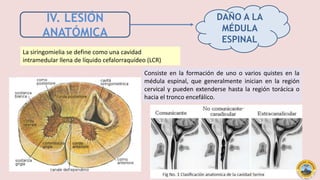 IV. LESIÓN
ANATÓMICA
La siringomielia se define como una cavidad
intramedular llena de líquido cefalorraquídeo (LCR)
Consiste en la formación de uno o varios quistes en la
médula espinal, que generalmente inician en la región
cervical y pueden extenderse hasta la región torácica o
hacia el tronco encefálico.
DAÑO A LA
MÉDULA
ESPINAL
 