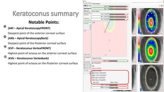 Sirius CSO The other face of Pentacam | PDF