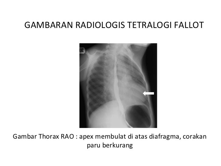 Sirkulasi darah fetal