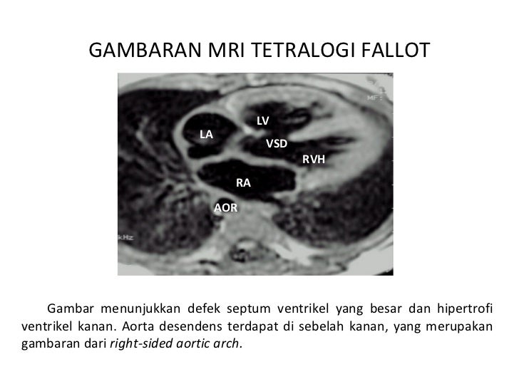 Sirkulasi darah fetal