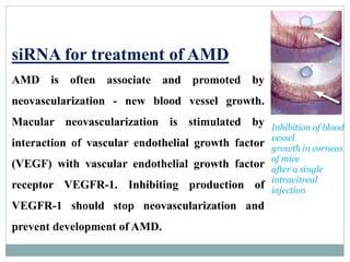 siRNA for treatment of AMD
AMD is often associate and promoted by
neovascularization - new blood vessel growth.
Macular neovascularization is stimulated by
interaction of vascular endothelial growth factor
(VEGF) with vascular endothelial growth factor
receptor VEGFR-1. Inhibiting production of
VEGFR-1 should stop neovascularization and
prevent development of AMD.
Inhibition of blood
vessel
growth in corneas
of mice
after a single
intravitreal
injection
 