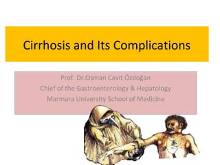 Cirrhosis and Its Complications
Prof. Dr.Osman Cavit Özdoğan
Chief of the Gastroenterology & Hepatology
Marmara University School of Medicine
 