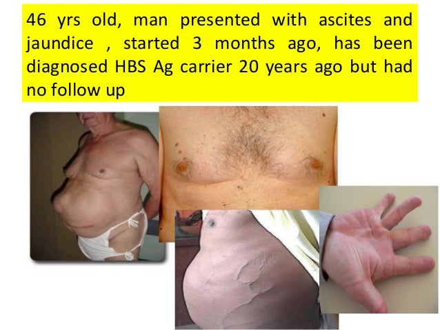 Exame hbs ag