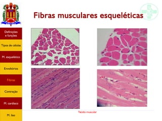 Tecido muscular
Fibras musculares esqueléticas
Tipos de células
Definições
e funções
Fibras
M. esquelético
Envoltórios
Contração
M. cardíaco
M. liso
 