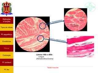 Tecido muscular
CORTE TRANSVERSAL
CORTE LONGITUDINAL
Lâmina 100x e 400x
Língua
(Hematoxilina-Eosina)
Tipos de células
Definições
e funções
Fibras
M. esquelético
Envoltórios
Contração
M. cardíaco
M. liso
 