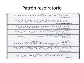Patrón respiratorio
 