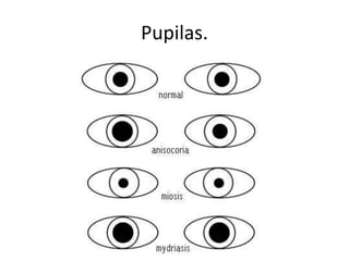 Pupilas.
 