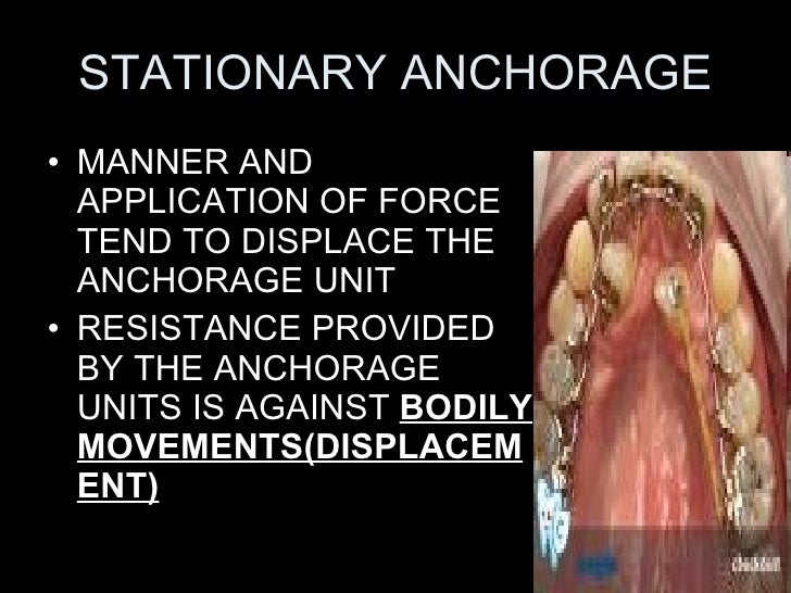 anchorage in orthodontics