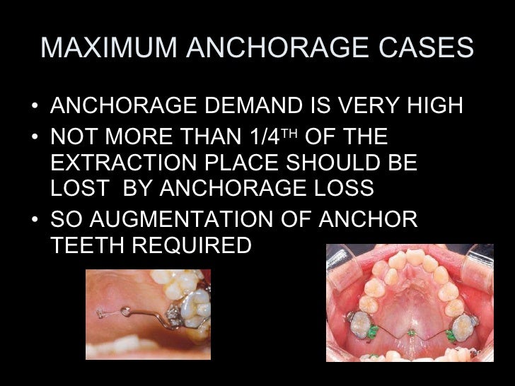 anchorage in orthodontics