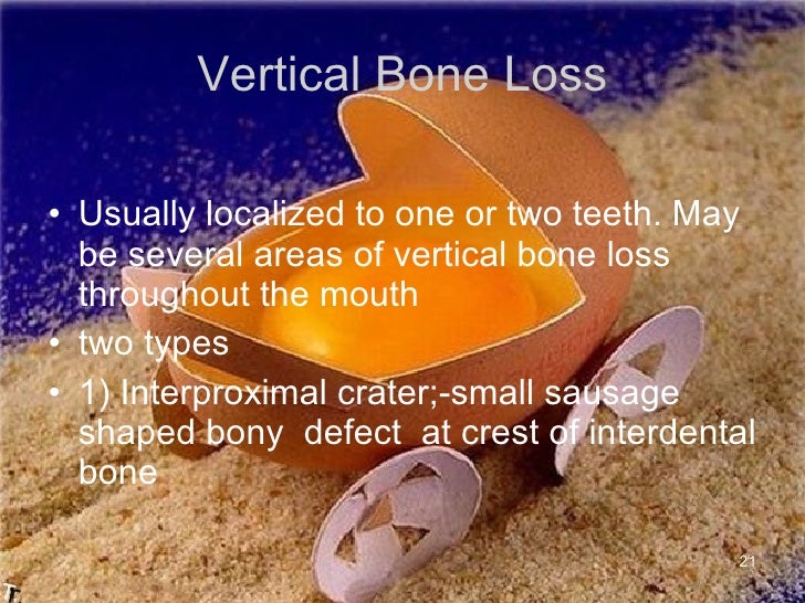 radiographic diagnosis of periodontal disease