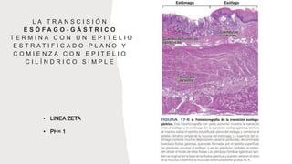 L A T R A N S C I S I Ó N
E S Ó F A G O - G Á S T R I C O
T E R M I N A C O N U N E P I T E L I O
E S T R A T I F I C A D O P L A N O Y
C O M I E N Z A C O N E P I T E L I O
C I L Í N D R I C O S I M P L E
• LINEA ZETA
• PH= 1
 