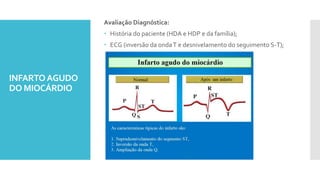 INFARTOAGUDO
DO MIOCÁRDIO
Avaliação Diagnóstica:
 História do paciente (HDA e HDP e da família);
 ECG (inversão da ondaT e desnivelamento do seguimento S-T);
 