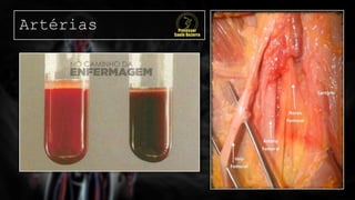 Artérias
 