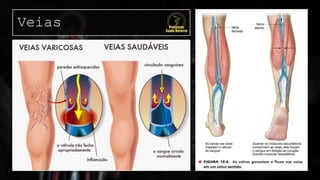 Veias
 