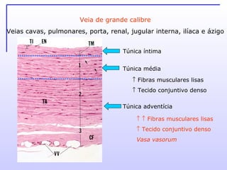 Veia de grande calibre Veias cavas, pulmonares, porta, renal, jugular interna, ilíaca e ázigo Túnica íntima Túnica média Túnica adventícia    Fibras musculares lisas    Tecido conjuntivo denso       Fibras musculares lisas    Tecido conjuntivo denso Vasa vasorum 
