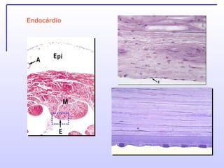 Endocárdio 