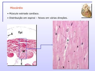 Miocárdio Músculo estriado cardíaco. Distribuição em espiral – feixes em várias direções. 