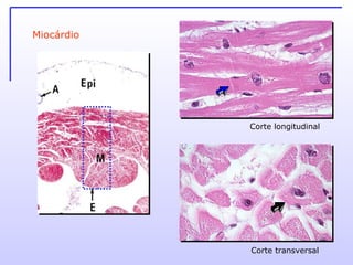 Miocárdio Corte longitudinal Corte transversal 